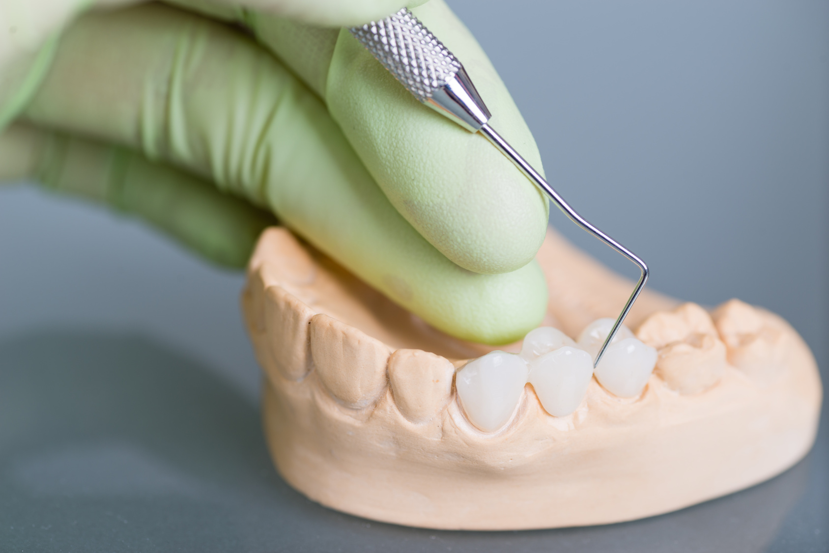 Crown & Bridges & Dentures