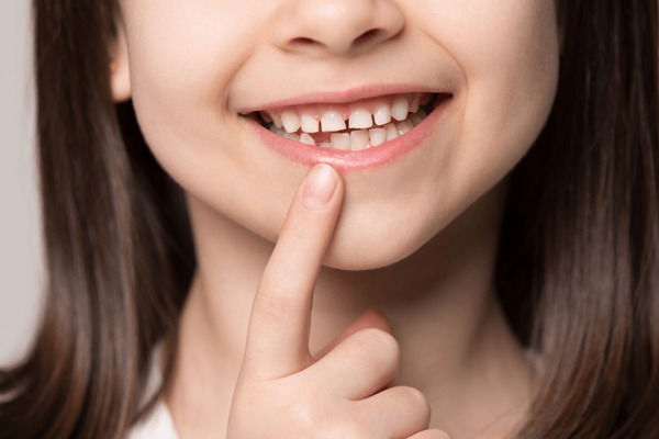 Growing up Smiling