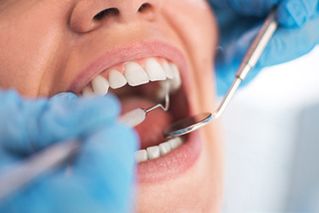 Dental Checkup