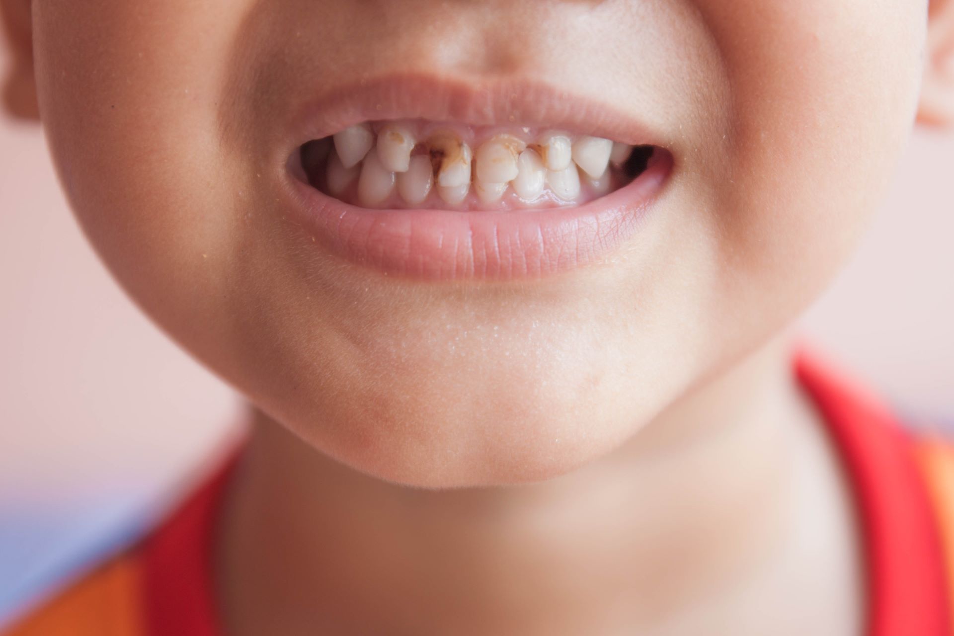 Early Dental Care