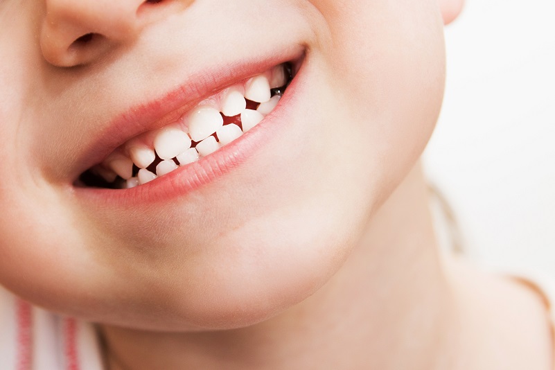 Milk Teeth
